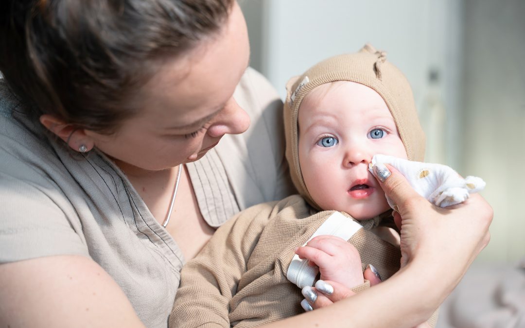 Can Babies Have Seasonal Allergies?