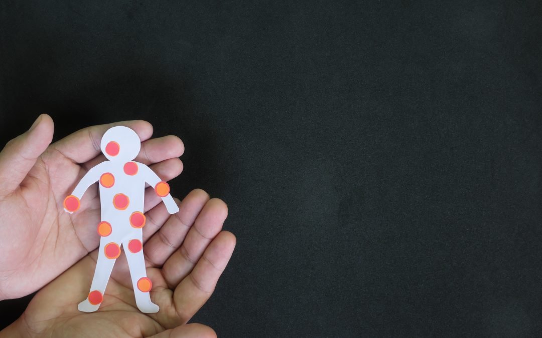 Why is There an Outbreak of Measles?